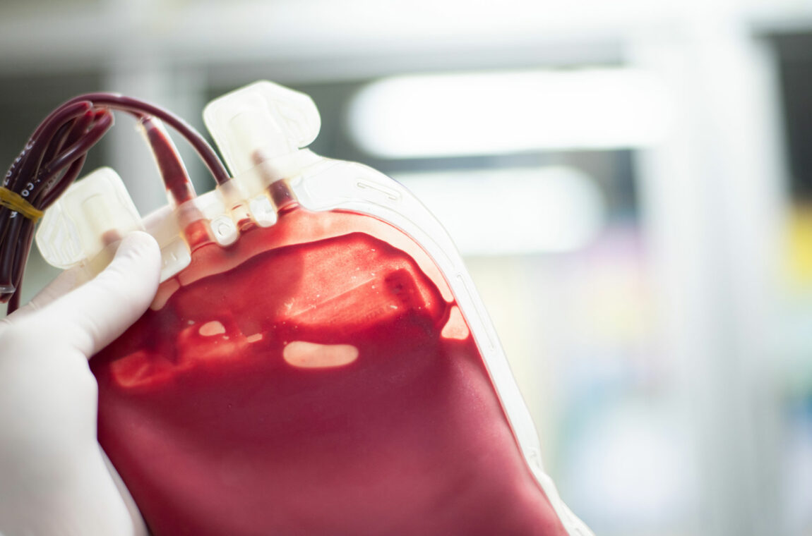 A wide variety of plastics are used in medicine Here in the picture: disposable gloves, blood bags and tubes
