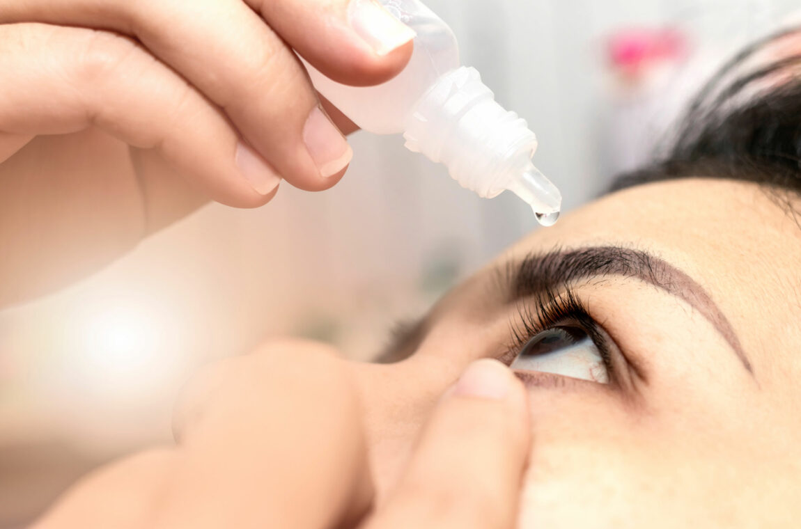 A woman drops eye drops into her eye.